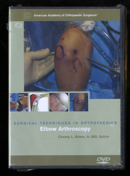Image for Elbow Arthroscopy